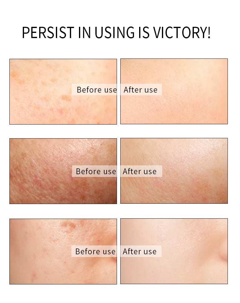 Mỹ phẩm làm trắng da trẻ hóa Nhà máy OEM ODM