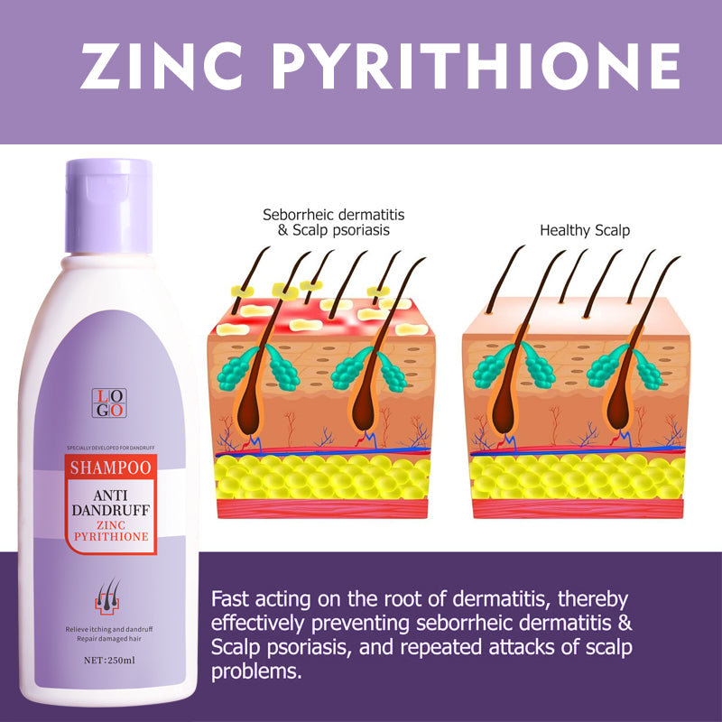 Nhà máy chế biến dầu gội chống gàu kẽm pyrithione OEM